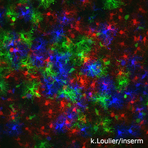 Astrocytes du cortex cérébral murin, grossissement 40x.